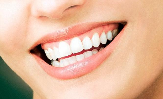 How Veneers Can Help You Upgrade Your Smile