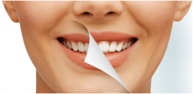 What is Cosmetic Dentistry?