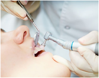 Other Than Cleanings, How Often Should You See Your Dentist?