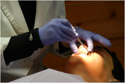 Root canal by Los Angeles Dentist
