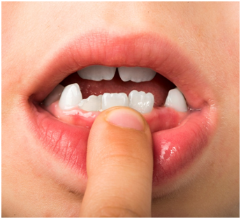 dentist in Los Angeles
