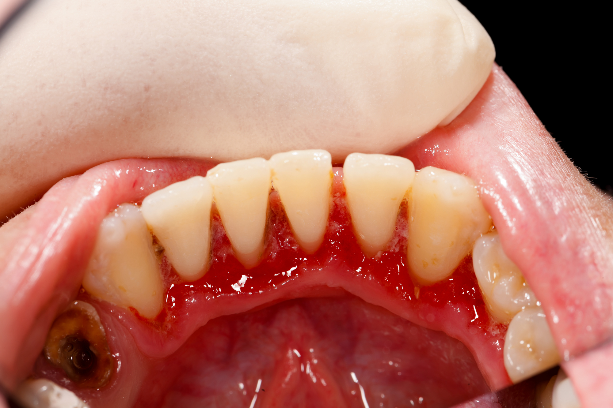Dentist in Los Angeles