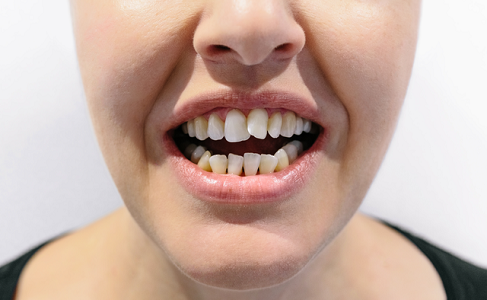 Dentist in Los Angeles | Crystal Dental