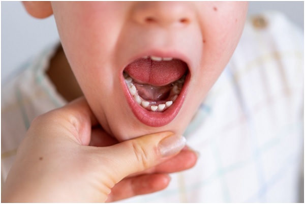 Pediatric dentist Los Angeles