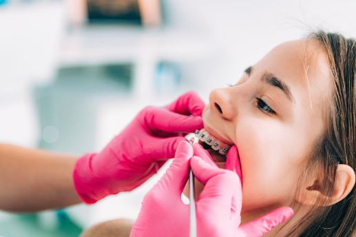 invisalign west Hollywood